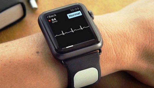 Đồng hồ thông minh có thể phát hiện sớm tình trạng suy tim